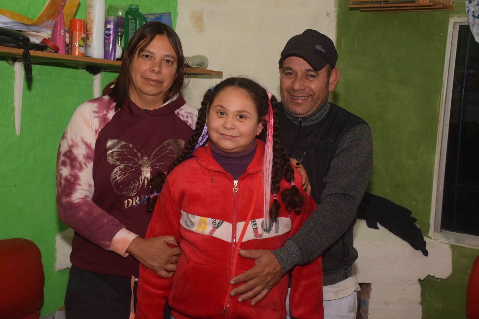 Niña de Ciudad del Plata nació con microcefalia y necesita ayuda para gastos médicos